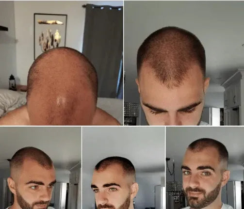 🧬Rolon Bodywise estimula el crecimiento de tu cabello con el efecto del romero